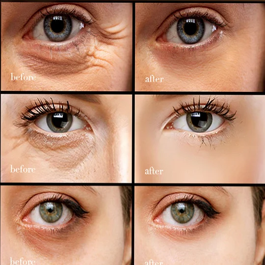 The EyeAwake Cream - The End of Tired-Looking Eyes - 50% OFF