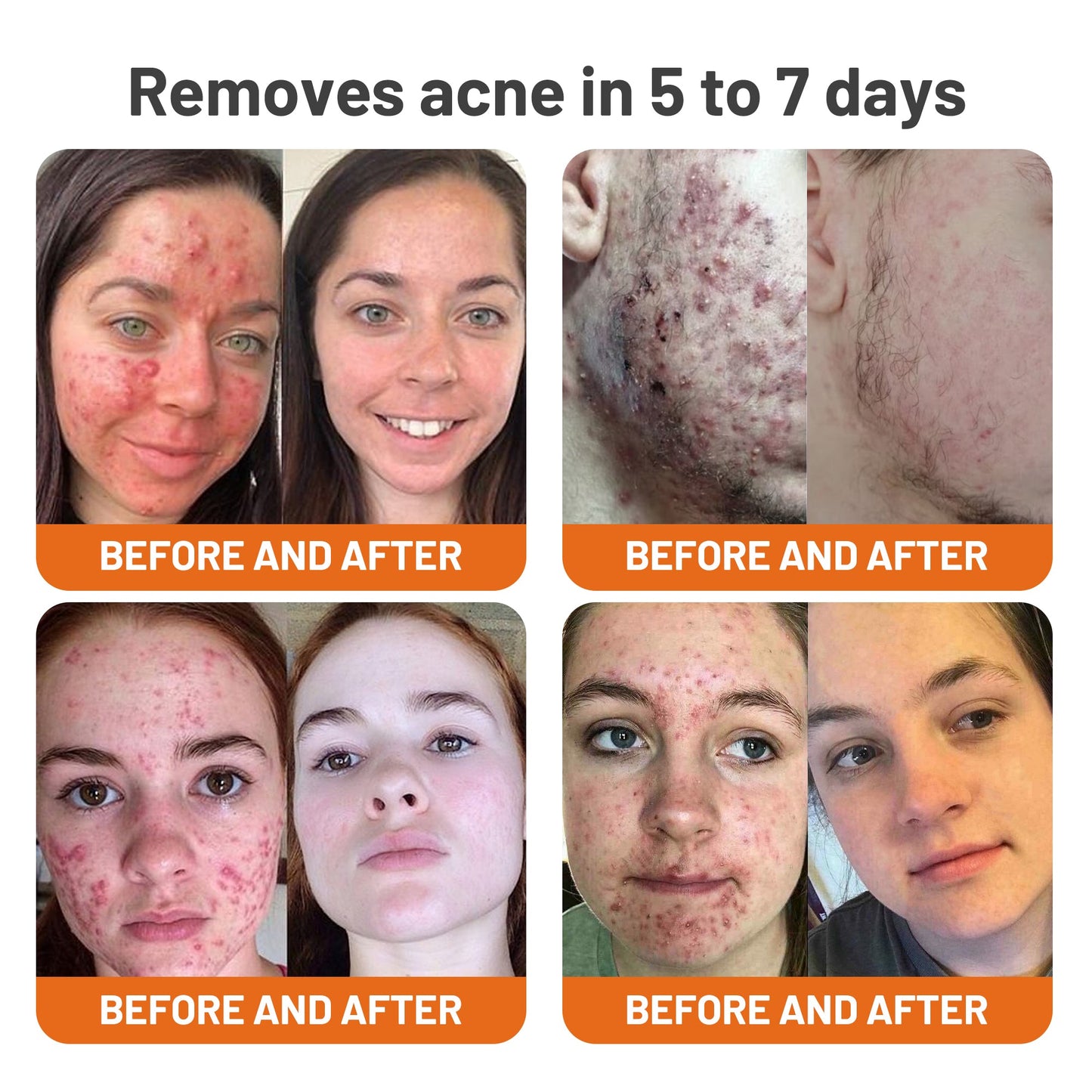 YouthRenew PM Mask – Wake Up to Radiant, Youthful Skin - 1+1 FREE