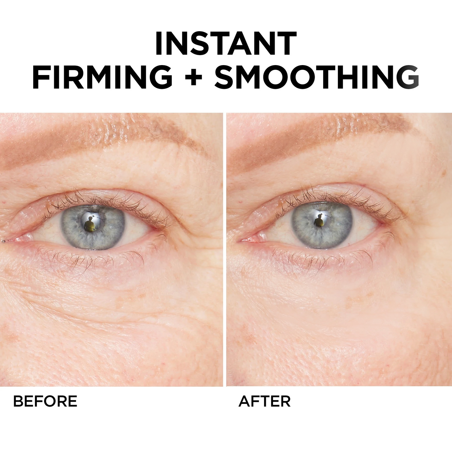 Ageless Aura Instant Lift + Erase Years in Seconds, Reveal a Timeless, Vibrant Gaze - 50% OFF