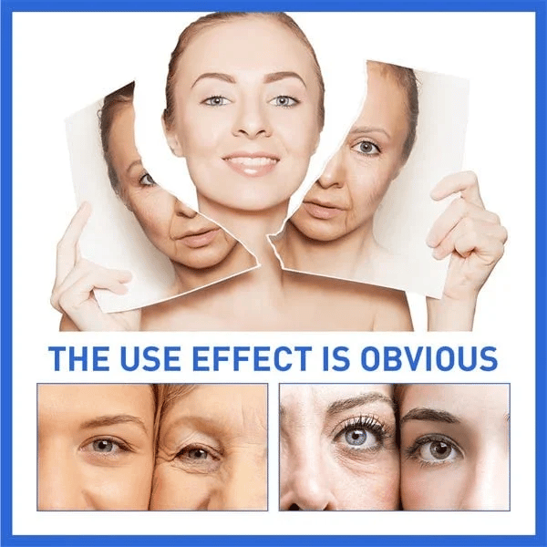 NeuroTox Serum - The Needle-Free Wrinkle Solution - 50% OFF