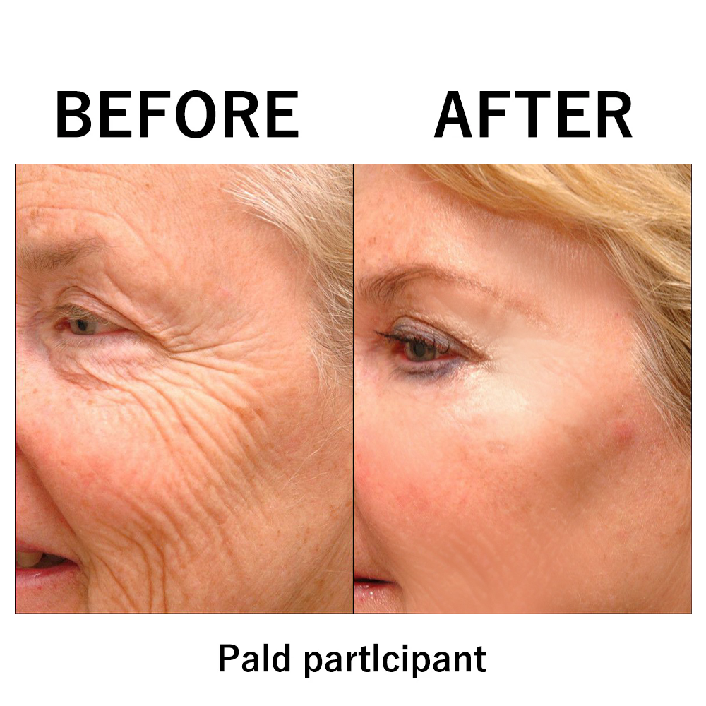 The Facelift Film - Look Years Younger, Instantly - 50% OFF
