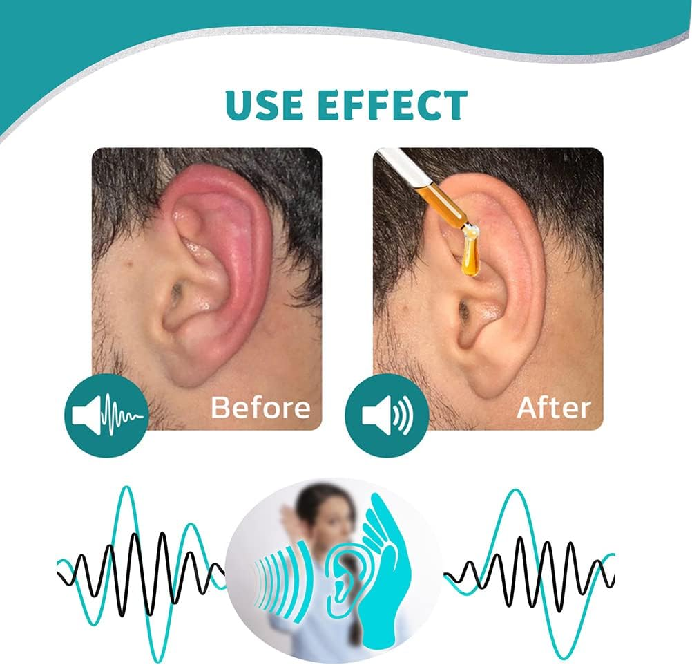 SereneEar Elixir - Quiet the Noise, Soothe the Itch - 1+1 FREE