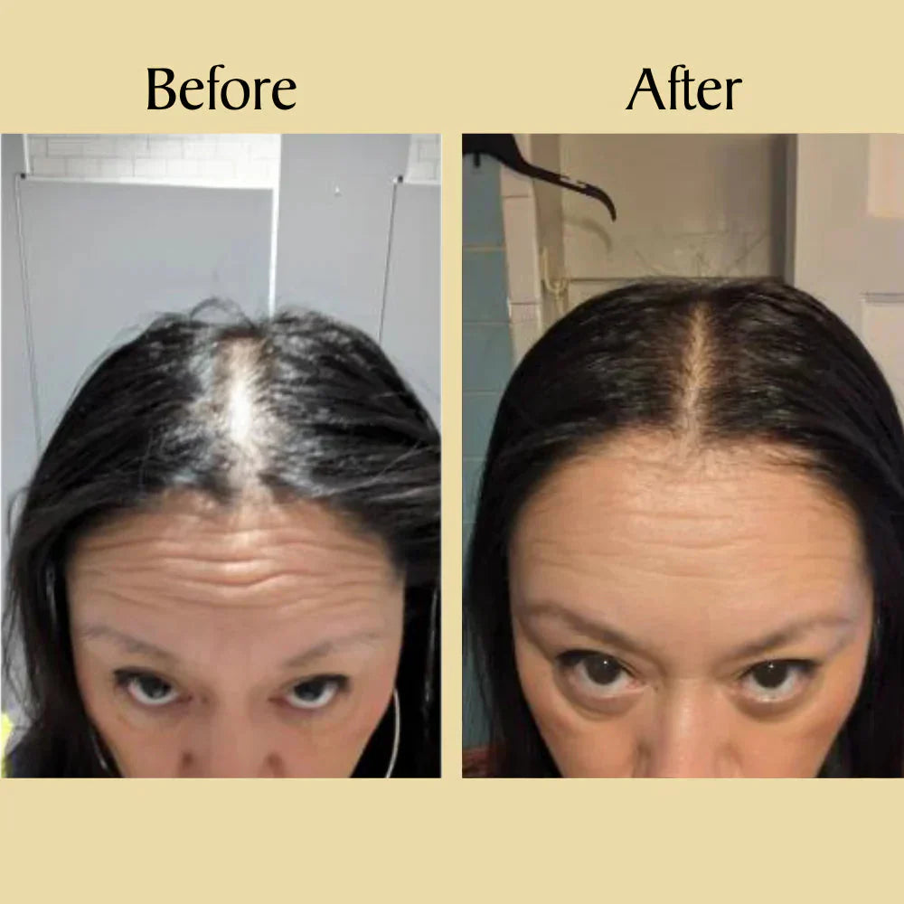 Batana Hair Growth Oil (75% OFF TODAY)