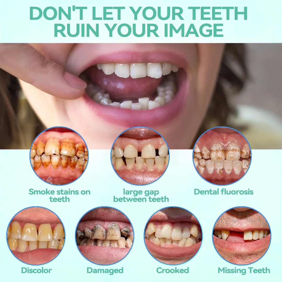 FlexiSmile Dentures - A Secure Smile, A Youthful Face + 50% OFF