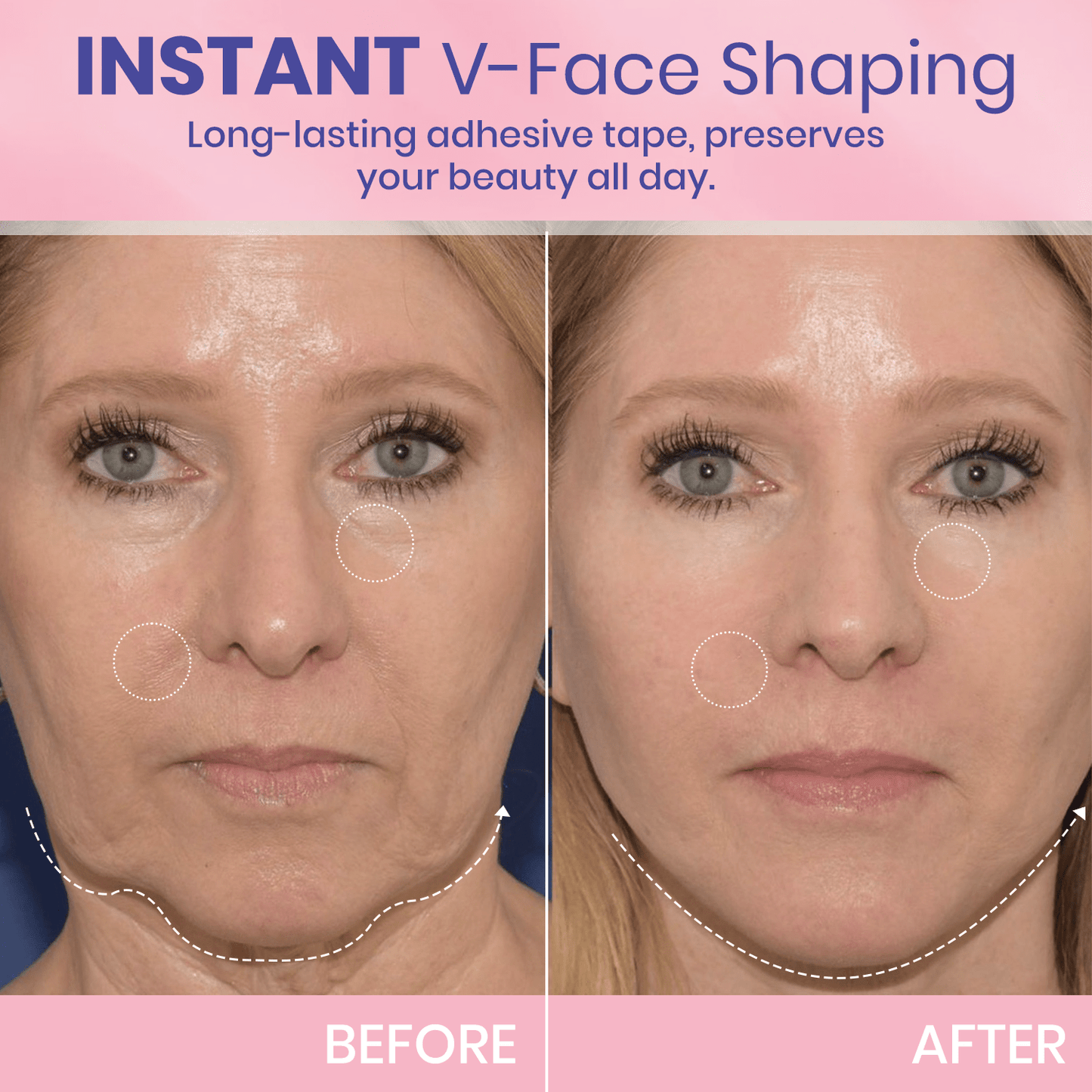 1 + 1 FREE - Instant V-Lift Tape – Lift Years Off Instantly!