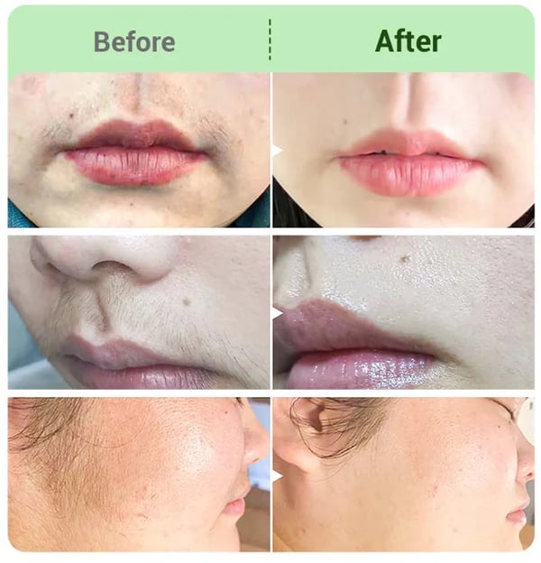 DermaSmooth - Silky-Smooth Skin, Zero Irritation - 50% OFF