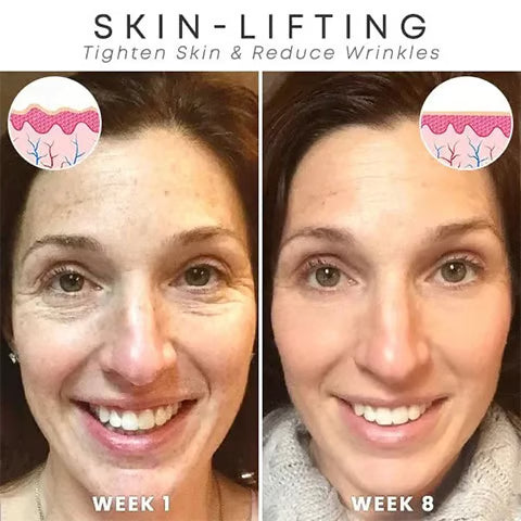 DermaClarity Elixir - Erase Post-Acne Marks - 50% OFF