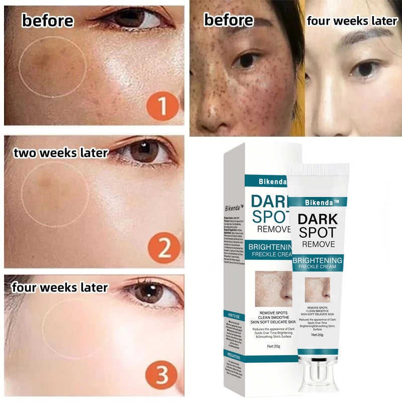 The Bikenda Beauty Cream - Fade Spots & Wrinkles, Fast + 50% OFF