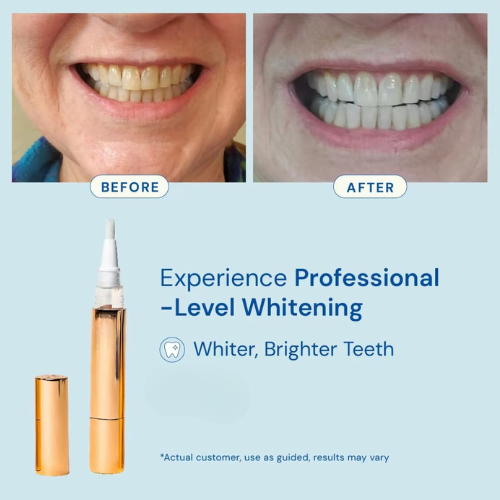 GleamWhite Pen – Your Instant Smile Transformation - 1+1 FREE