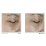 Revive + Glow Eye Balm with Vitamin C brightens and reduces puffiness 65 - 50% OFF