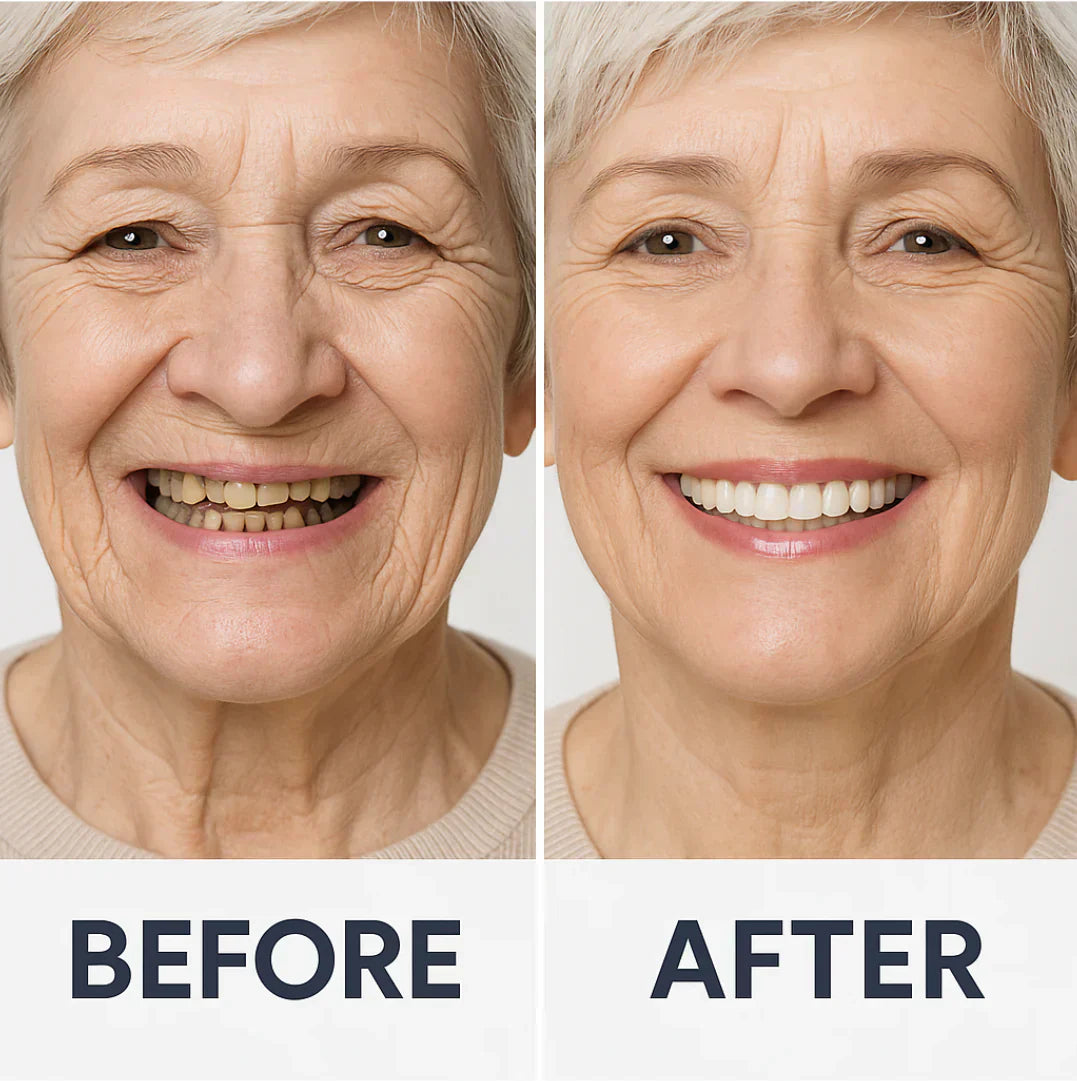 Comfort-Fit Flexible Dentures – Natural Look Easy Wear & Removal - 60% OFF