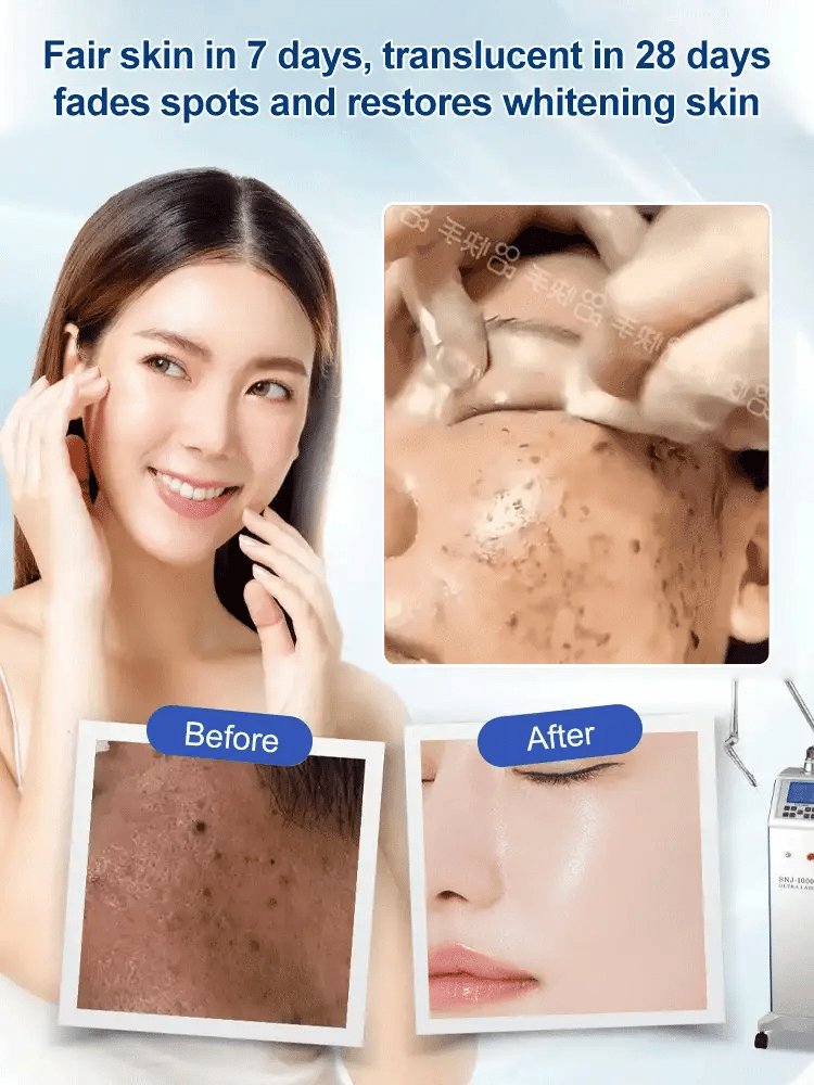 The DermaClear Complex - Erase Dark Spots, Restore Clarity - 50% OFF