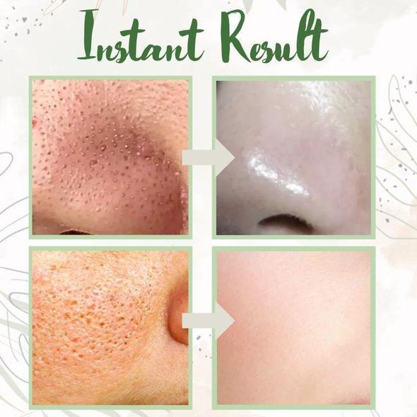 1 + 1 FREE - GreenCleanse Stick – Effortlessly Purify Your Skin & Reveal Your Natural Radiance