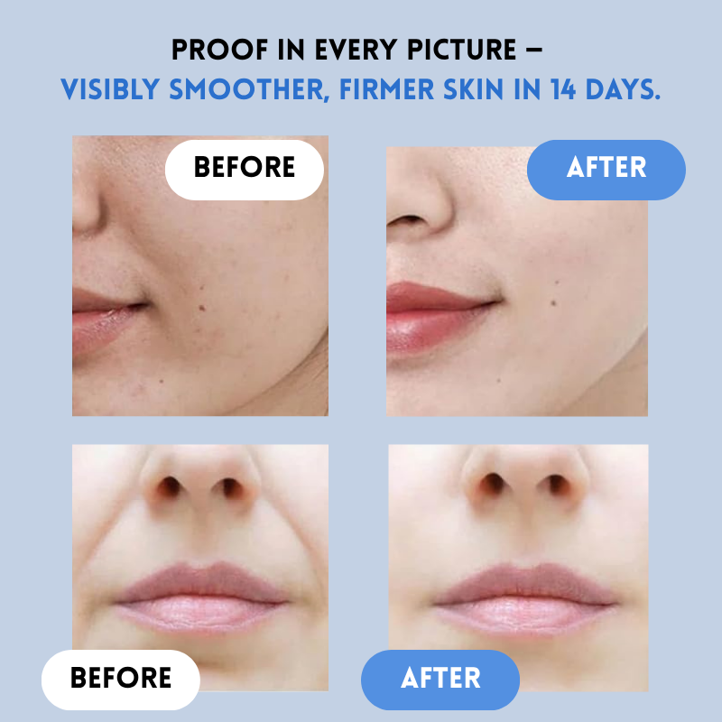 YouthLift Renew Strips – The Instant Solution for Timeless Beauty - Buy More Save More