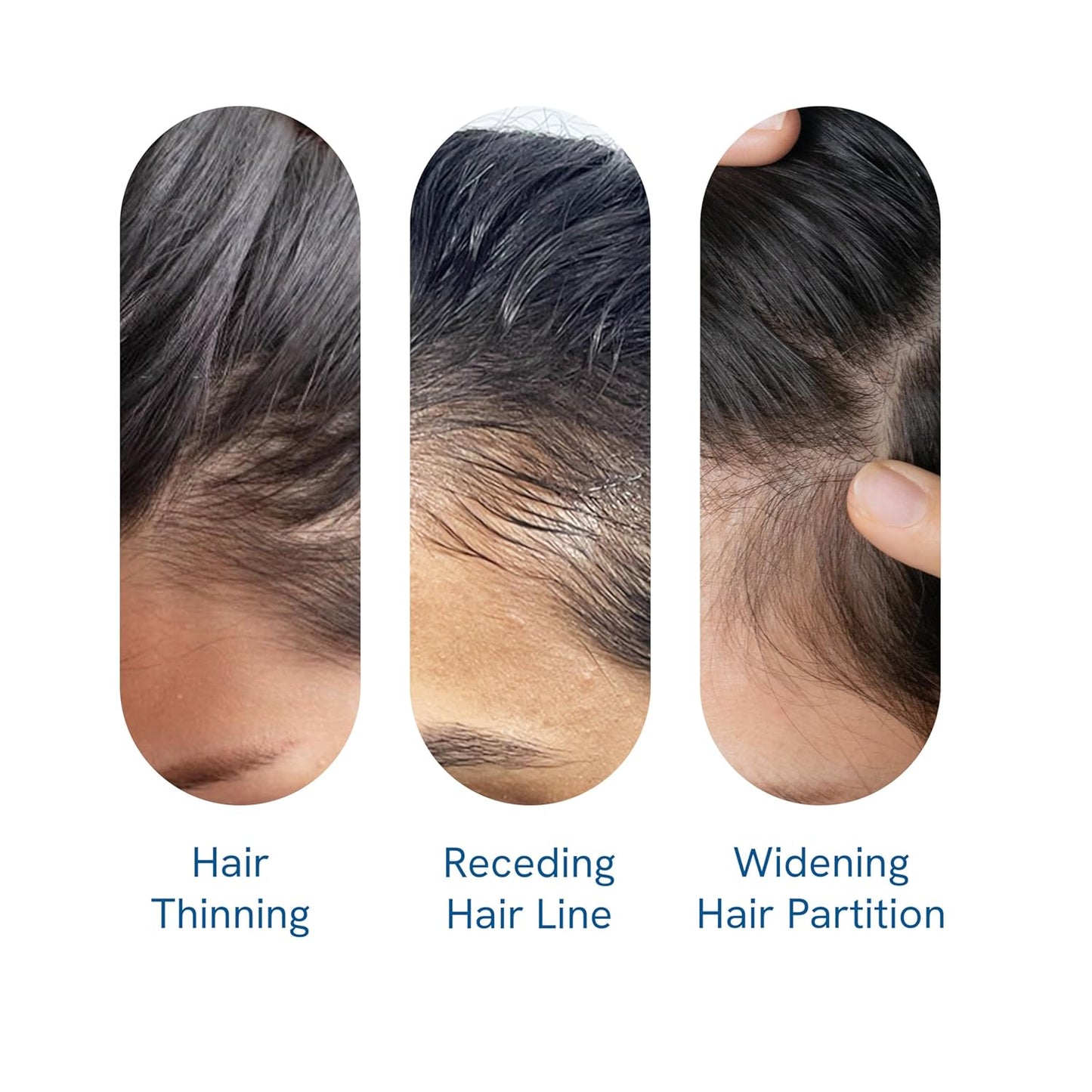 FolliRevive - Reawaken Your Hair Follicles - 50% OFF