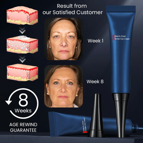 RadiantEyes Firming Eye Gel – Achieve Brighter, Firmer, Youthful-Looking Eyes - 1+1 FREE