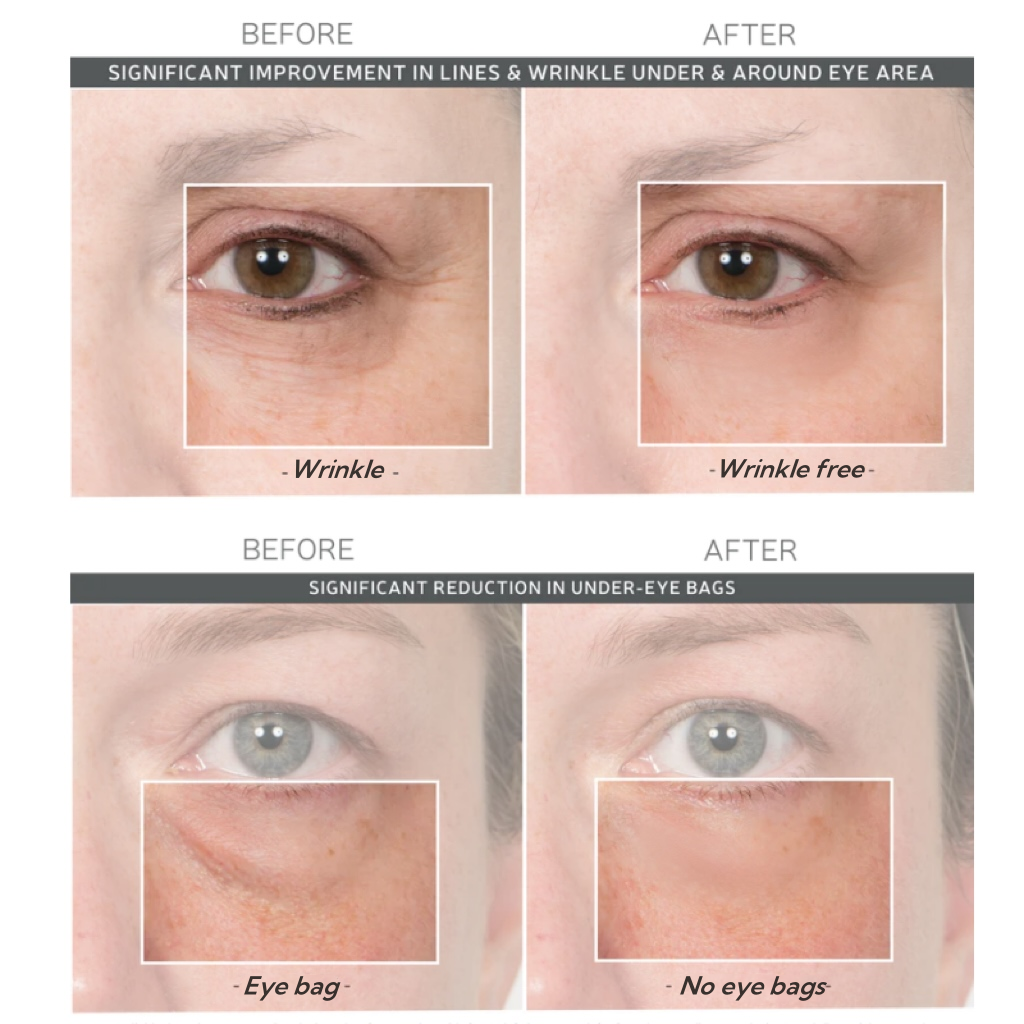 Ageless Aura Instant Lift + Erase Years in Seconds, Reveal a Timeless, Vibrant Gaze - 50% OFF