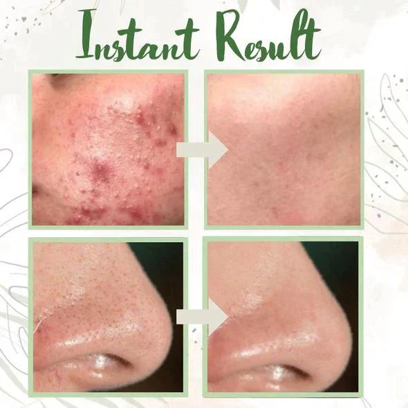 1 + 1 FREE - GreenCleanse Stick – Effortlessly Purify Your Skin & Reveal Your Natural Radiance
