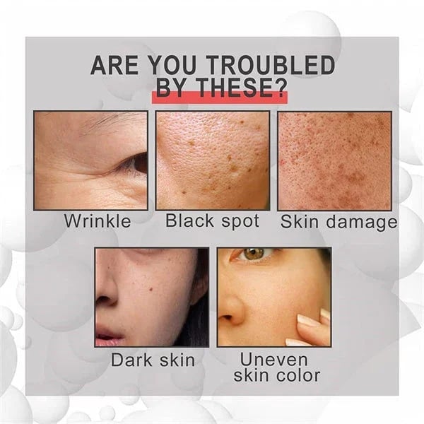 NeuroTox Serum - The Needle-Free Wrinkle Solution - 50% OFF