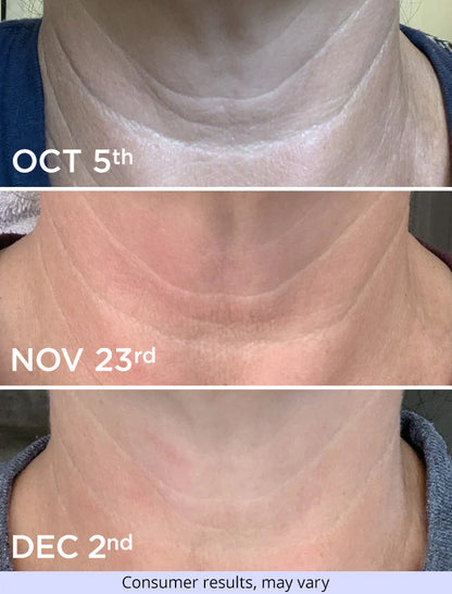 The DécolleFirm Cream - A Firmer, Younger-Looking Neck - 50% OFF