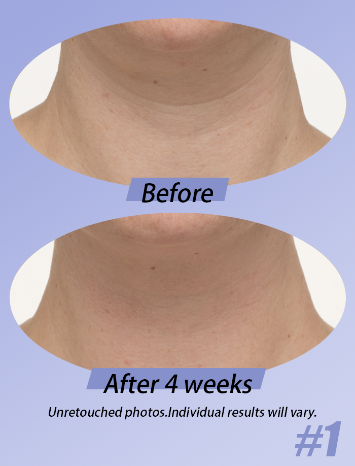 The DécolleFirm Cream - A Firmer, Younger-Looking Neck - 50% OFF