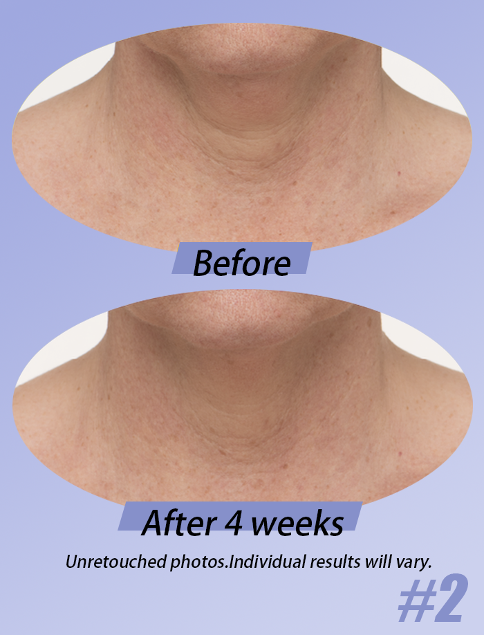 The DécolleFirm Cream - A Firmer, Younger-Looking Neck - 50% OFF