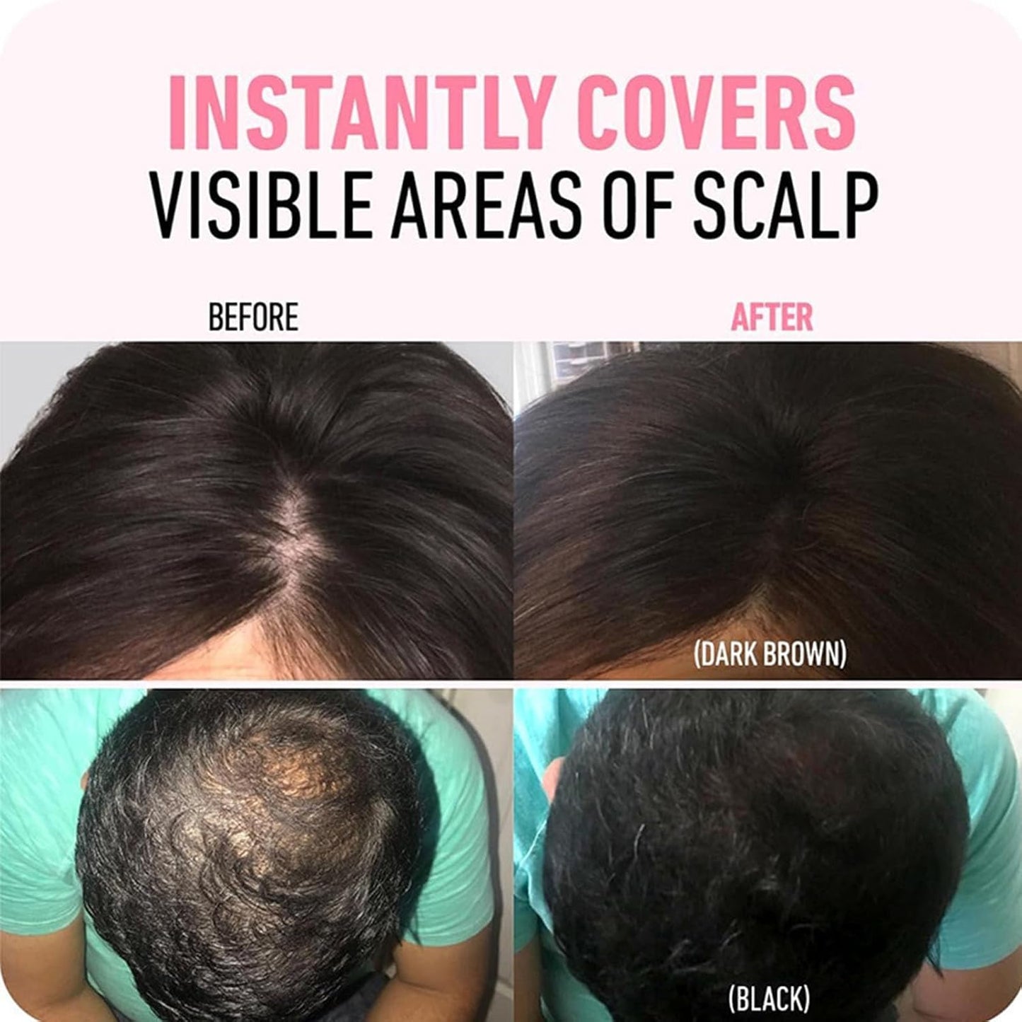 VeriFill Hair Transformer + Reclaim Your Confident, Full-Bodied Look - 50% OFF