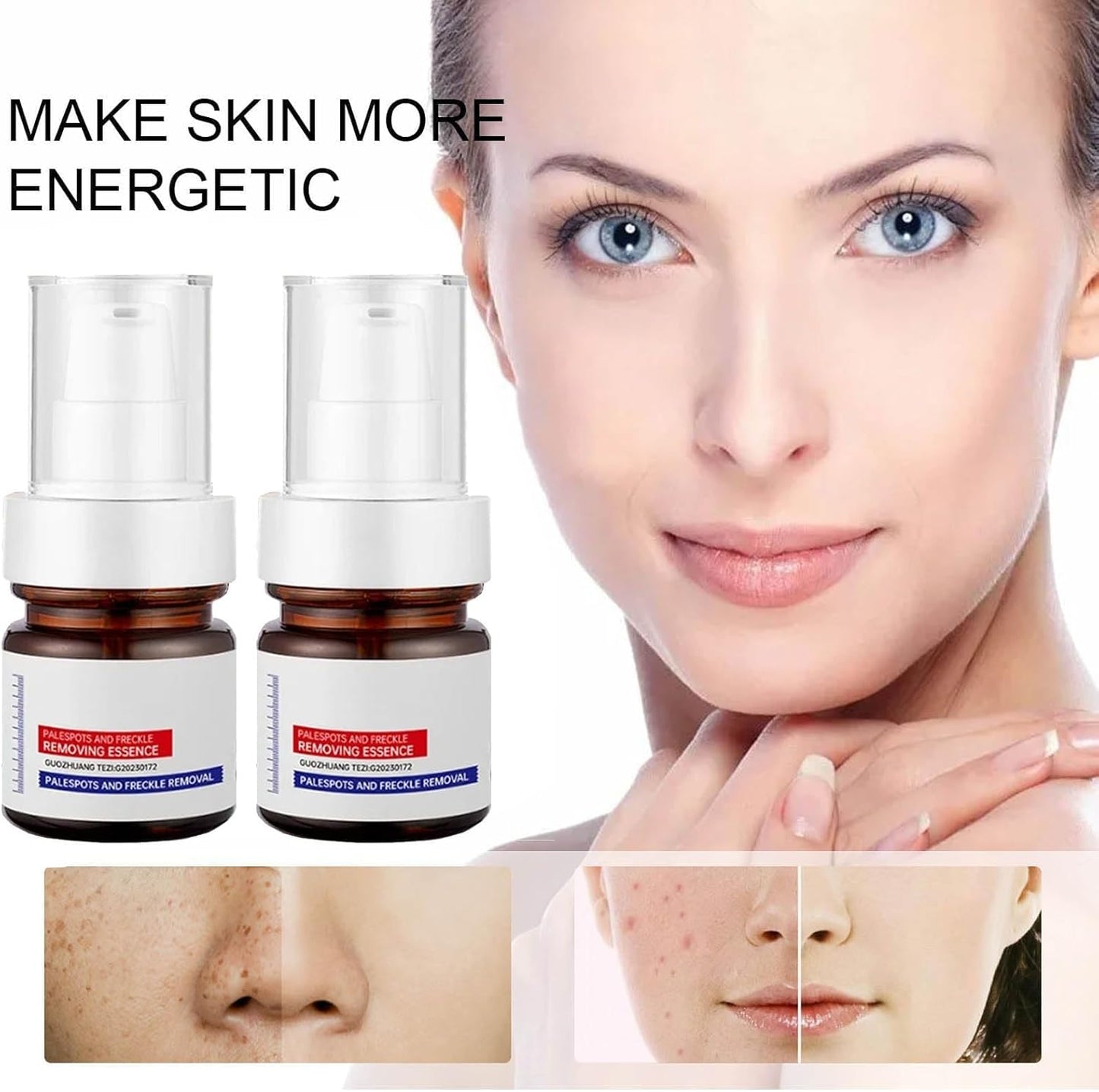 Vitamin C Whitening Freckles Face Cream (Radiant Renew) – Achieve Clear, Radiant, Even-Toned Skin- 50% OFF