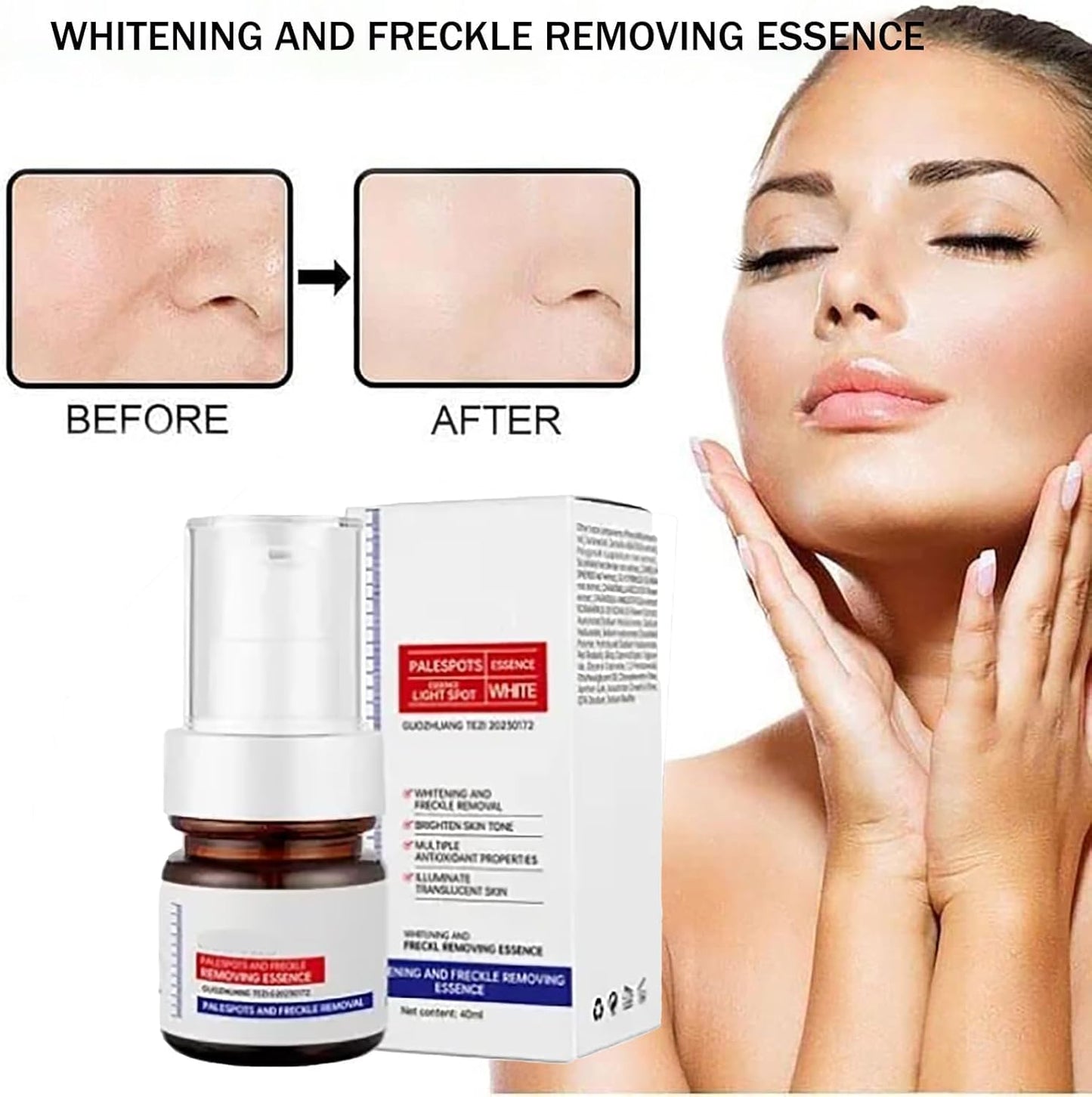 Vitamin C Whitening Freckles Face Cream (Radiant Renew) – Achieve Clear, Radiant, Even-Toned Skin- 50% OFF