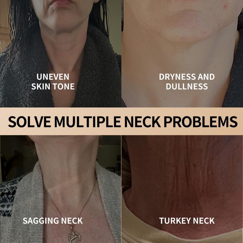 NeckRenew – Rediscover Your Youthful Neckline - 60% OFF