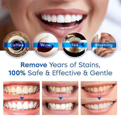 Ivory™ Teeth Whitening Essence (Limited Time Offer 50% Discount)