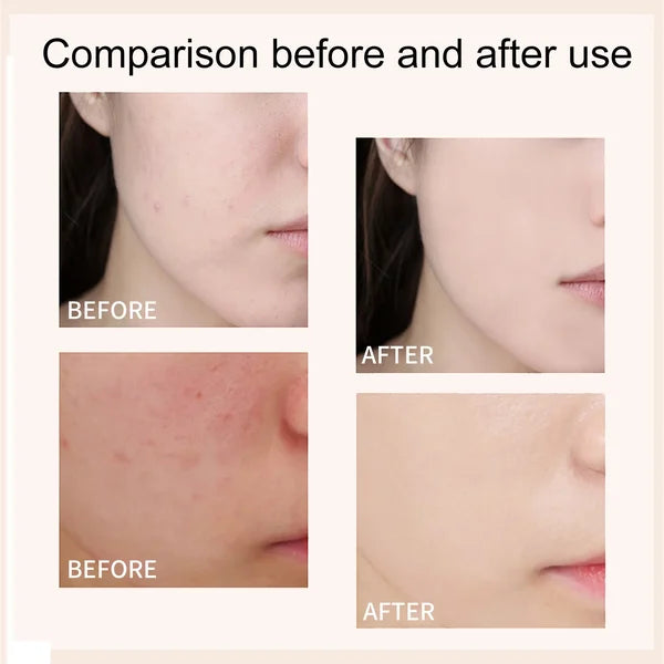 DermaMatch CC Cream - Your Perfect Shade, Guaranteed - 1+1 FREE