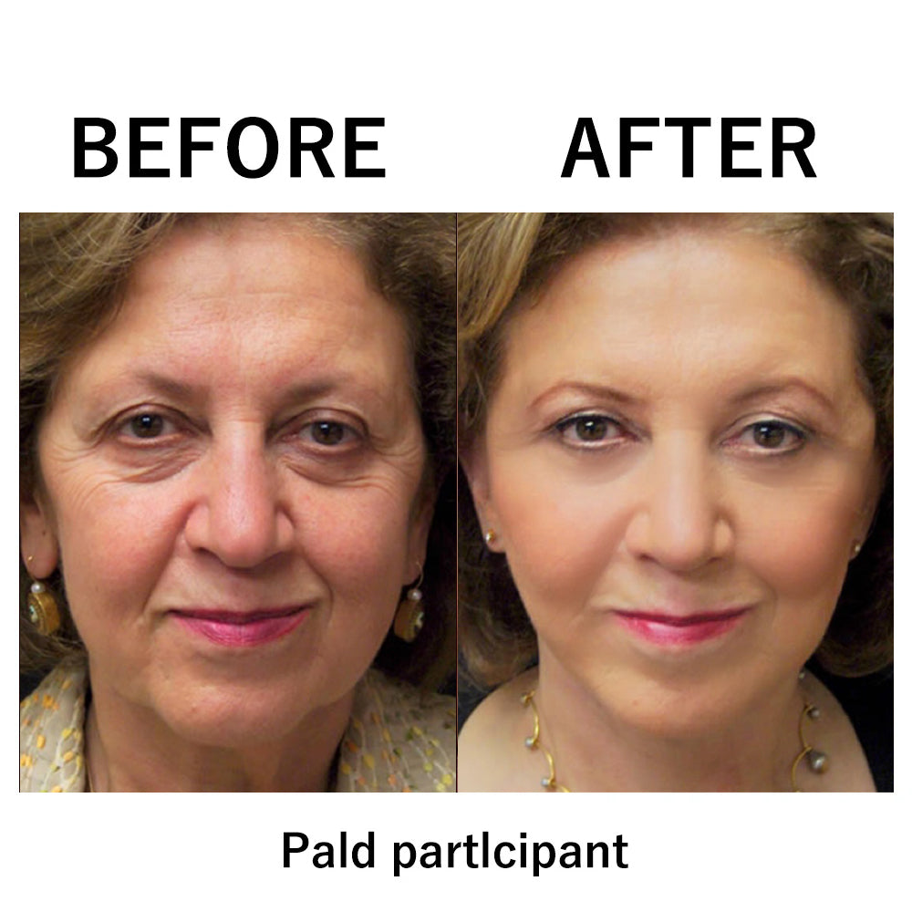 The Facelift Film - Look Years Younger, Instantly - 50% OFF