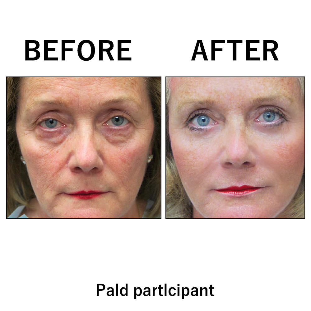 The Facelift Film - Look Years Younger, Instantly - 50% OFF