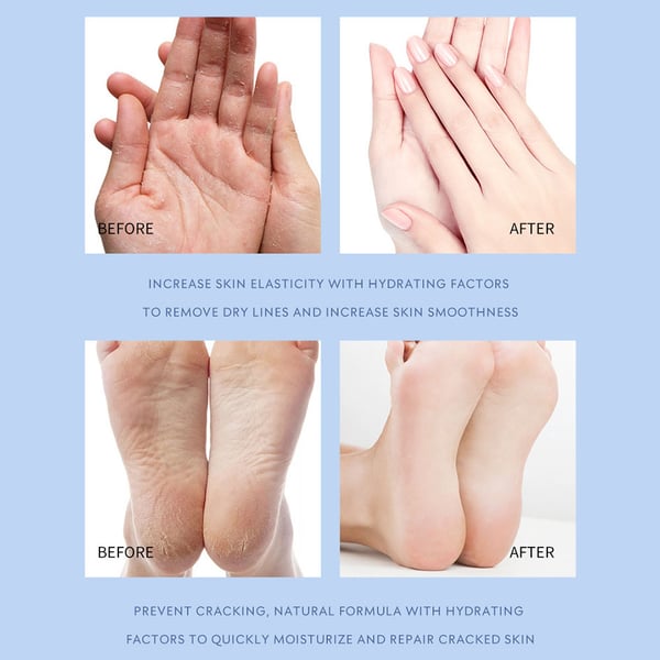 RejuvaSole Balm + Instantly Transform Dry, Cracked Feet into Soft, Supple Perfection - 50% OFF