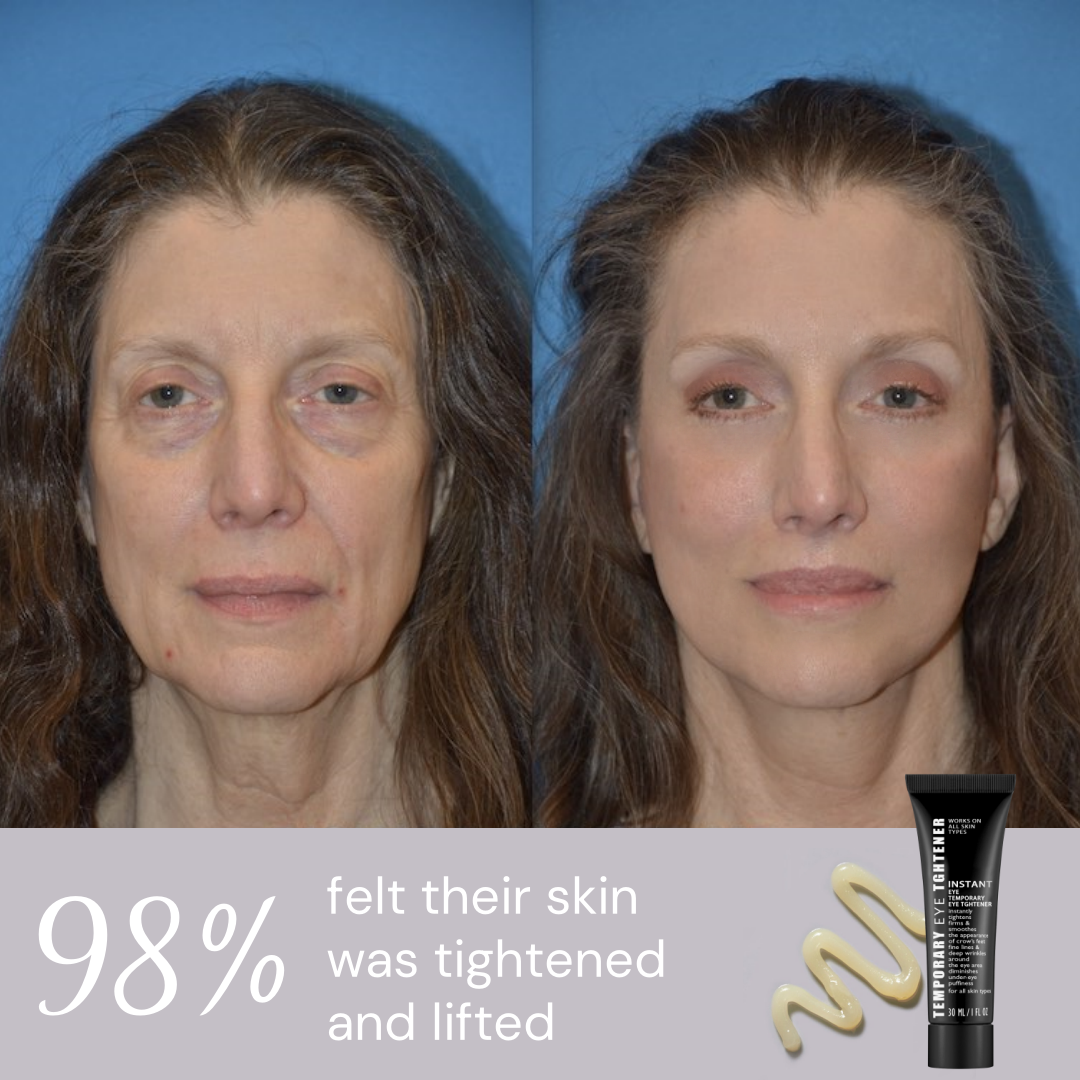 Ageless Aura Instant Lift + Erase Years in Seconds, Reveal a Timeless, Vibrant Gaze - 50% OFF