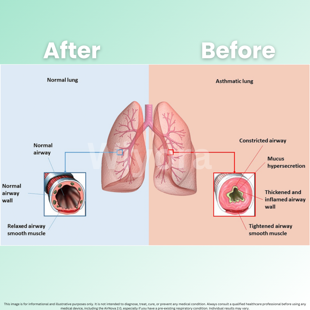 AirNova 2.0 - Breathe Easy, Anywhere + 50% OFF