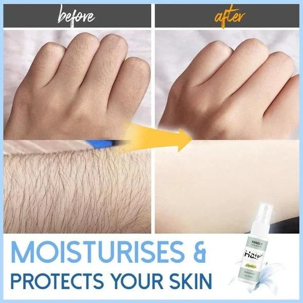 SmoothGlide – Effortless Hair Removal for Silky-Smooth Skin - 50% OFF