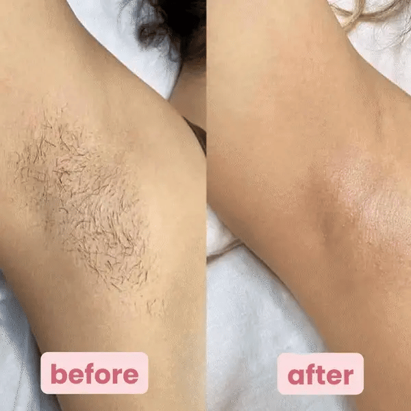 The PetalSmooth Shave Pro - A Perfect Shave, No Razor Burn + 50% OFF