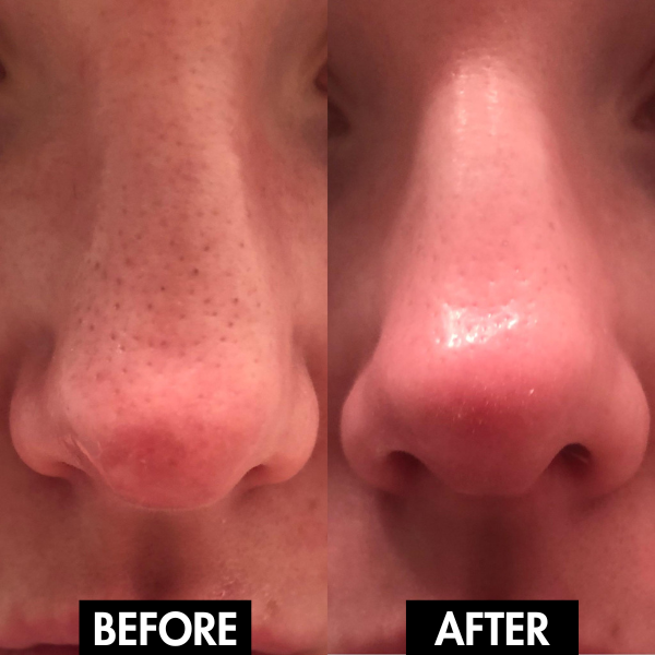 PureGlow: Your Solution for Radiant, Poreless Skin - 50% OFF