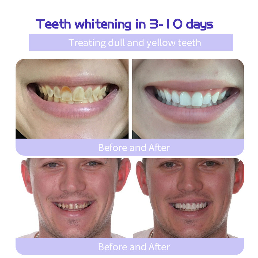 BBOJI™ Hydroxyapatite Toothpaste - Rebuild Enamel, End Sensitivity + 50% OFF
