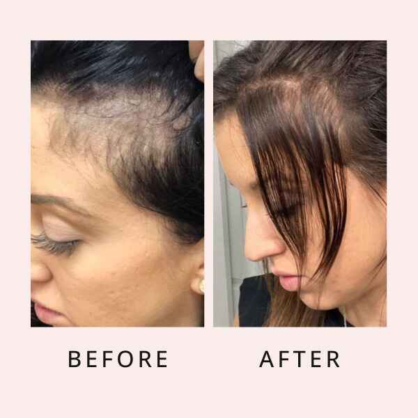 RootRenew Elixir - Reclaim Your Hair's Fullness - 50% OFF