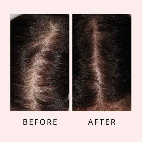 RootRenew Elixir - Reclaim Your Hair's Fullness - 50% OFF