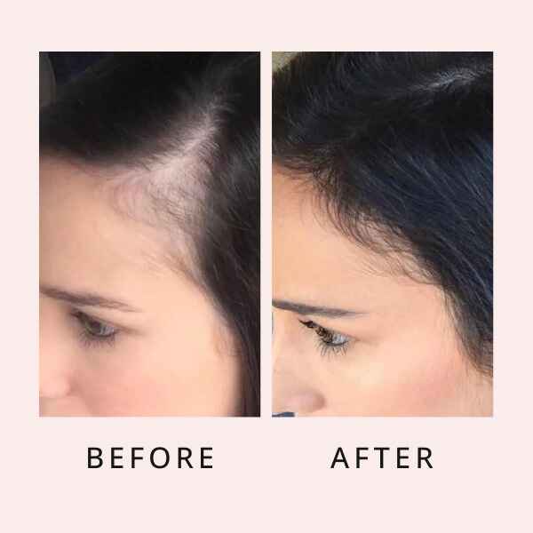 RootRenew Elixir - Reclaim Your Hair's Fullness - 50% OFF