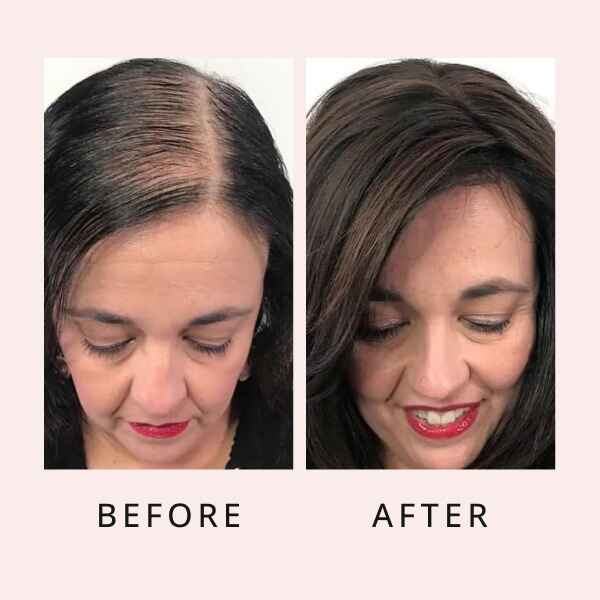 RootRenew Elixir - Reclaim Your Hair's Fullness - 50% OFF