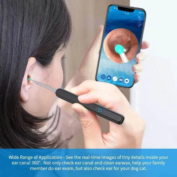 OtoScope HD - Clean Your Ears Safely, See Everything - 50% OFF