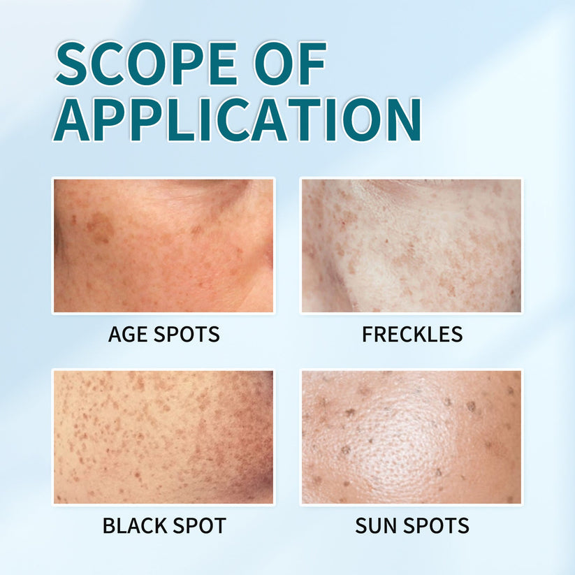 The Bikenda Beauty Cream - Fade Spots & Wrinkles, Fast + 50% OFF