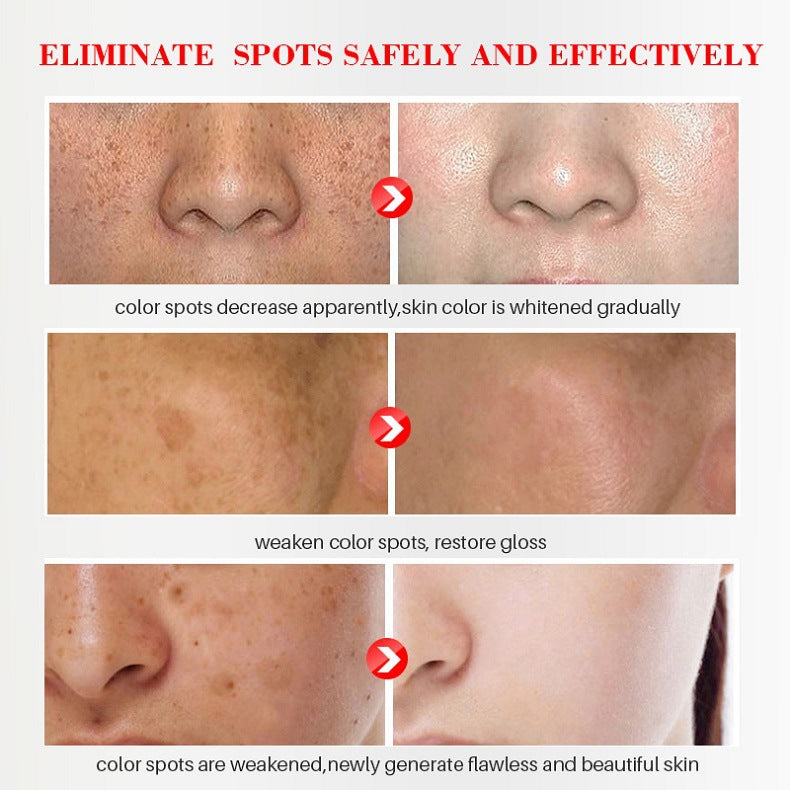 The Bikenda Beauty Cream - Fade Spots & Wrinkles, Fast + 50% OFF