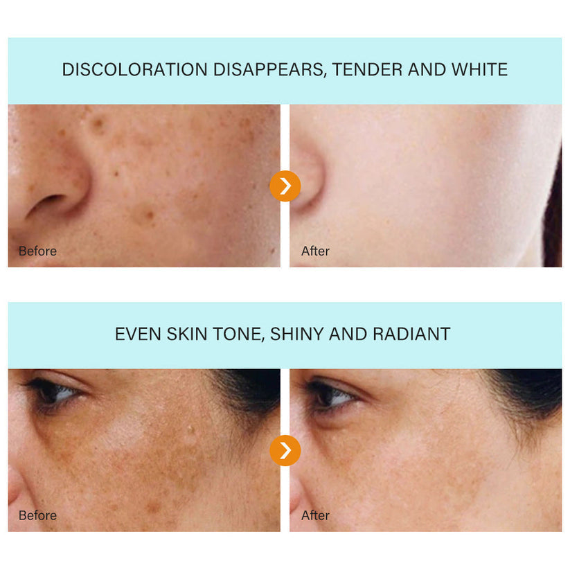 The Bikenda Beauty Cream - Fade Spots & Wrinkles, Fast + 50% OFF