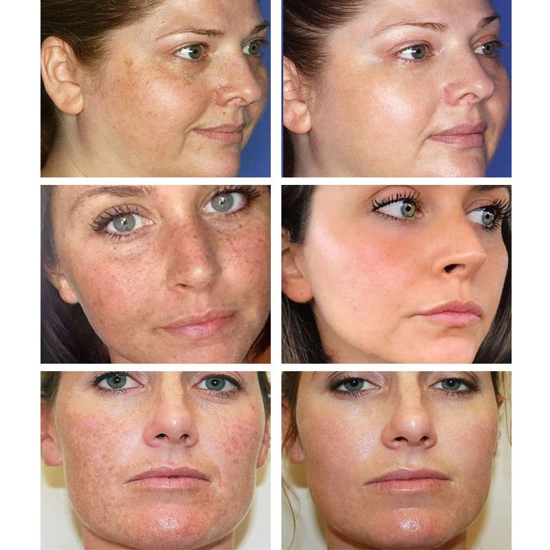 The Bikenda Beauty Cream - Fade Spots & Wrinkles, Fast + 50% OFF